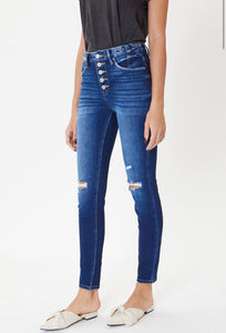All my Love - KanCan Button Skinny Jeans